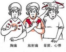 冠心病有哪些癥狀？