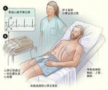 冠心病需要做哪些檢查？