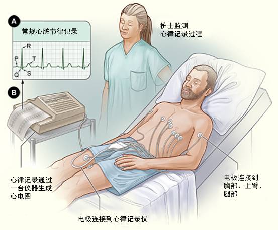 冠心病需要做哪些檢查？(圖1)