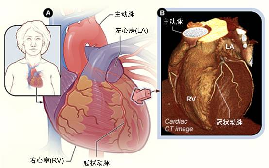 冠心病需要做哪些檢查？(圖2)